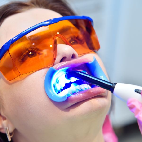 Quando falamos em clareamento dental personalizado, estamos referindo-nos não apenas a um tratamento estético temporário, mas a uma transformação de longo prazo no seu sorriso.