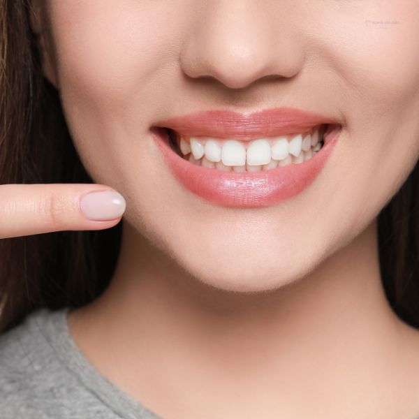 Gengivoplastia: O Procedimento que Transforma o seu Sorriso.