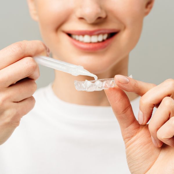 Clareamento Dental Sem Segredos: Como Garantir Resultados Seguros.