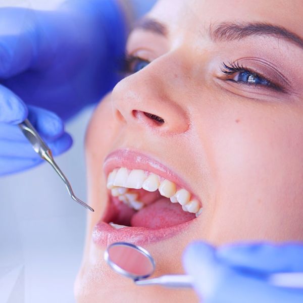 Frequência Ideal da Limpeza Dental Para um Sorriso Saudável.