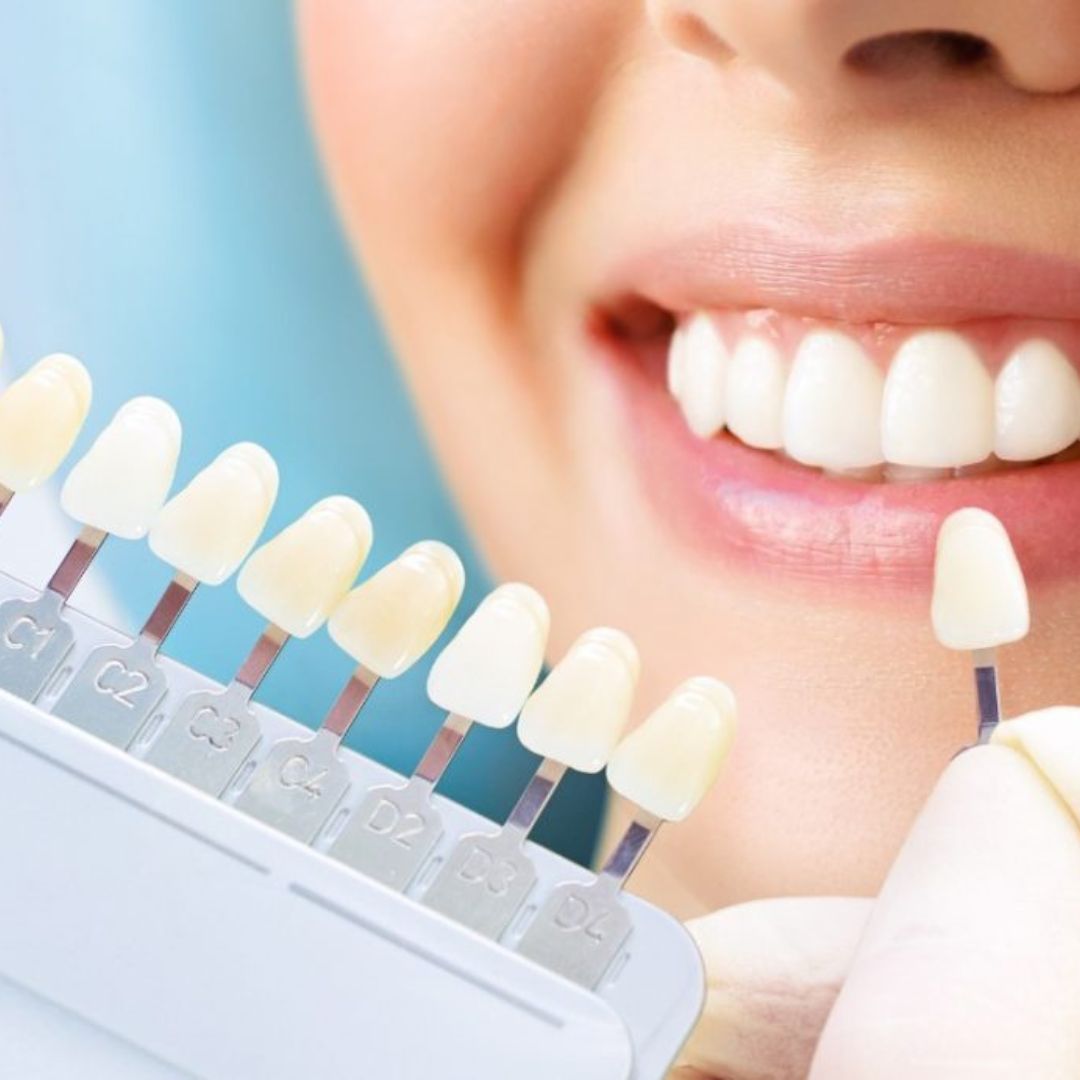 A odontologia estética tem se transformado rapidamente, com inovações recentes que revolucionam a forma como tratamos e realçamos sorrisos.