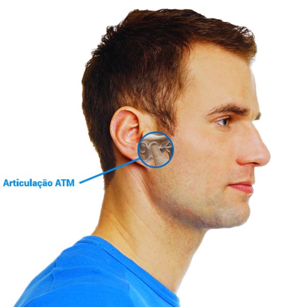 Quando a Cirurgia é Necessária no Tratamento da ATM.