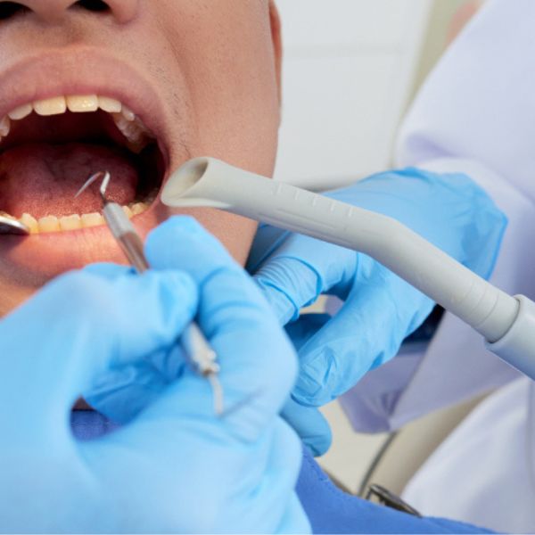 Tratamentos Eficazes para a Erosão Dentária que Restauram seu Sorriso.