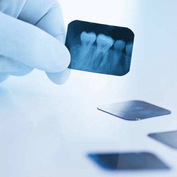 A Importância do Exame Odontológico Regular Para a Saúde Bucal.
