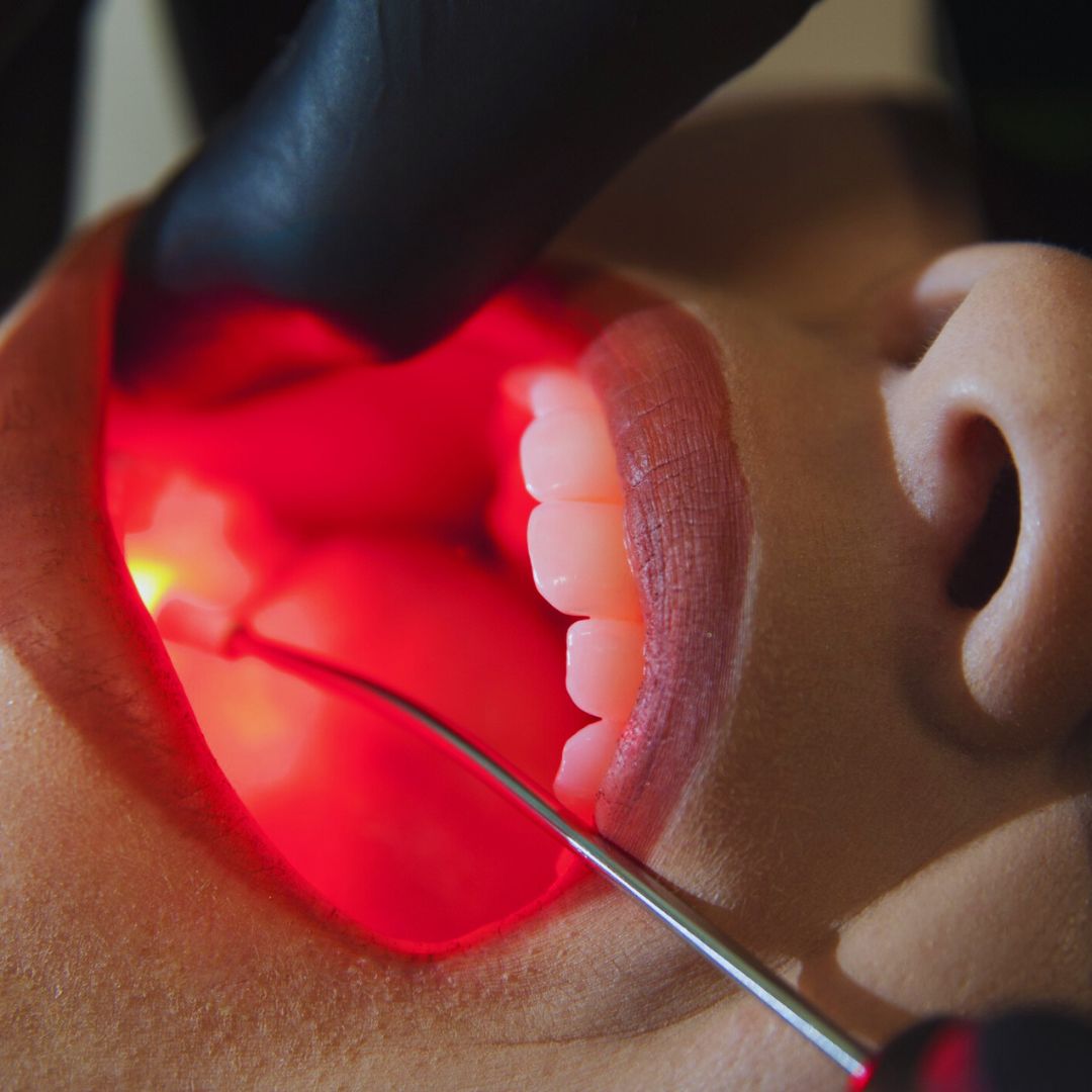 Os benefícios incluem redução da dor, aceleração da cicatrização e prevenção de doenças. Além disso, a laserterapia é uma alternativa menos invasiva, proporcionando mais conforto aos pacientes durante os tratamentos.