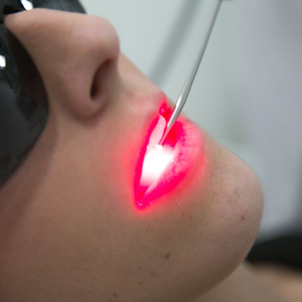 Prevenção de Doenças Bucais Através da Laserterapia na Odontologia.