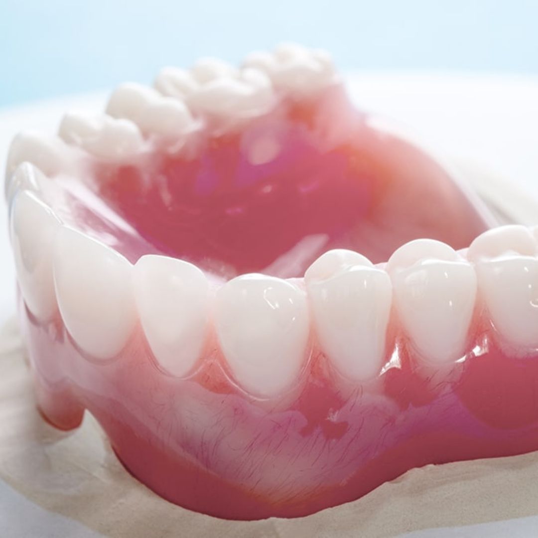 A prótese total, também conhecida como dentadura, é uma estrutura removível que visa substituir todos os dentes de uma arcada, seja superior ou inferior.