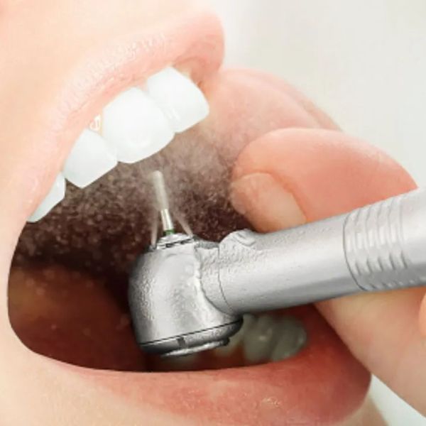 Quando é o Momento Ideal para Realizar a Limpeza Dentária.