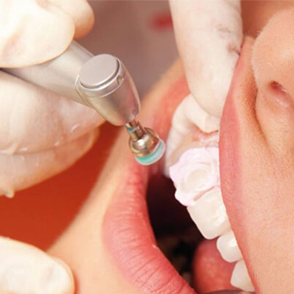 Quando é o Momento Ideal para Realizar a Limpeza Dentária.