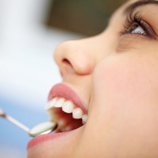 Como o Biofilme Dental Afeta a Saúde Bucal e Como Evitá-lo.