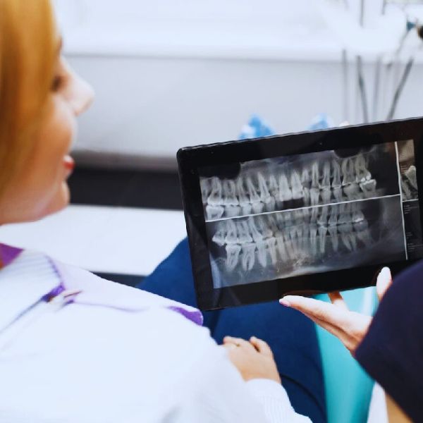 Dentes do Siso: Quando Extrair e Quando Manter?