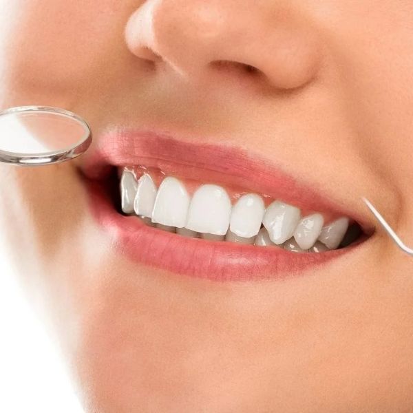 Lentes de Contato Dental: Preservação da Estrutura Dental Original.