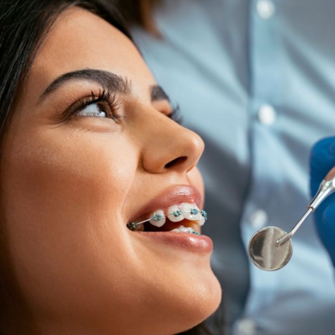 O tratamento ortodôntico na idade adulta é crucial não apenas para corrigir imperfeições estéticas, mas também para melhorar a saúde bucal geral.