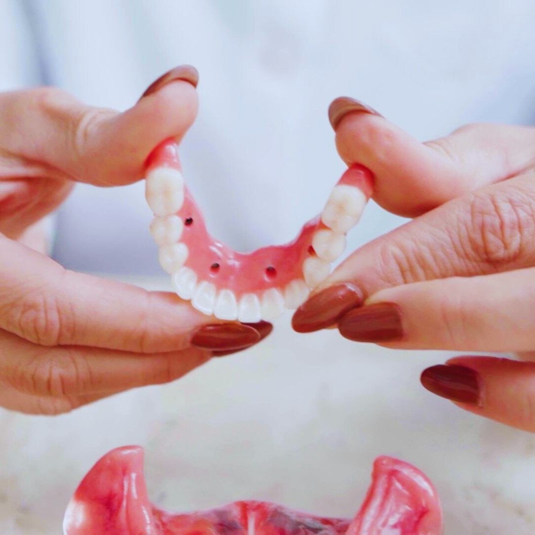 Os implantes unitários são projetados para substituir um único dente perdido de forma eficaz.