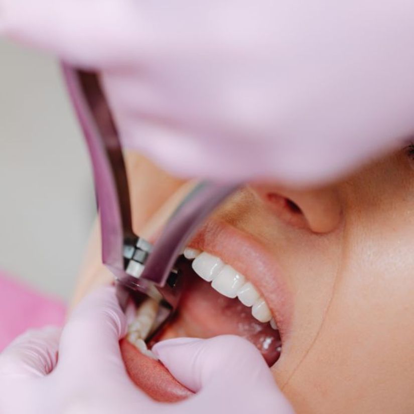Consultas Regulares ao Dentista como Prevenção da Infiltração Dental.
