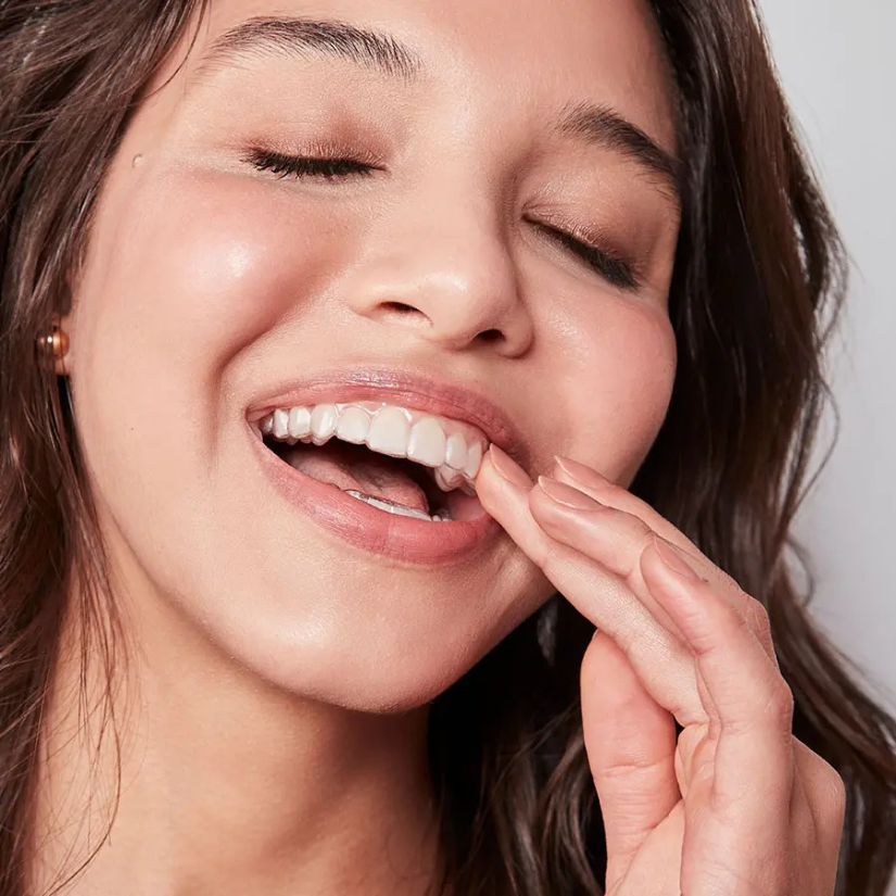 Como Funciona o Invisalign e o Processo de Alinhamento Dental.