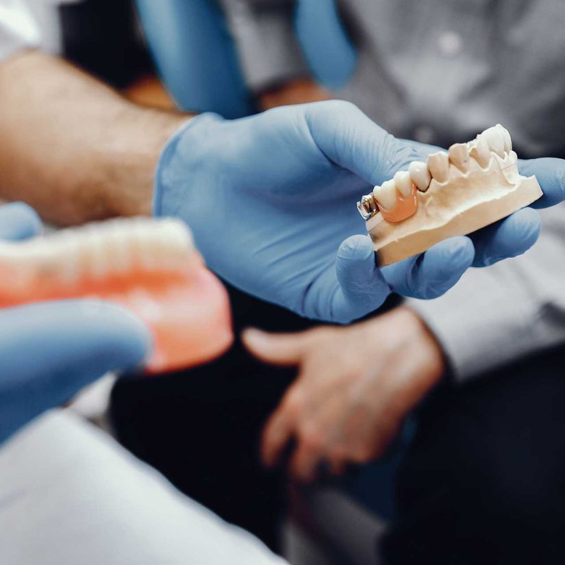 Prótese Fixa: Conheça os Tipos e os Benefícios.