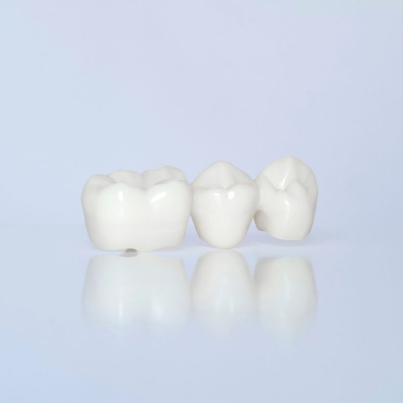 Coroas em Porcelana como Solução Estética e Funcional.