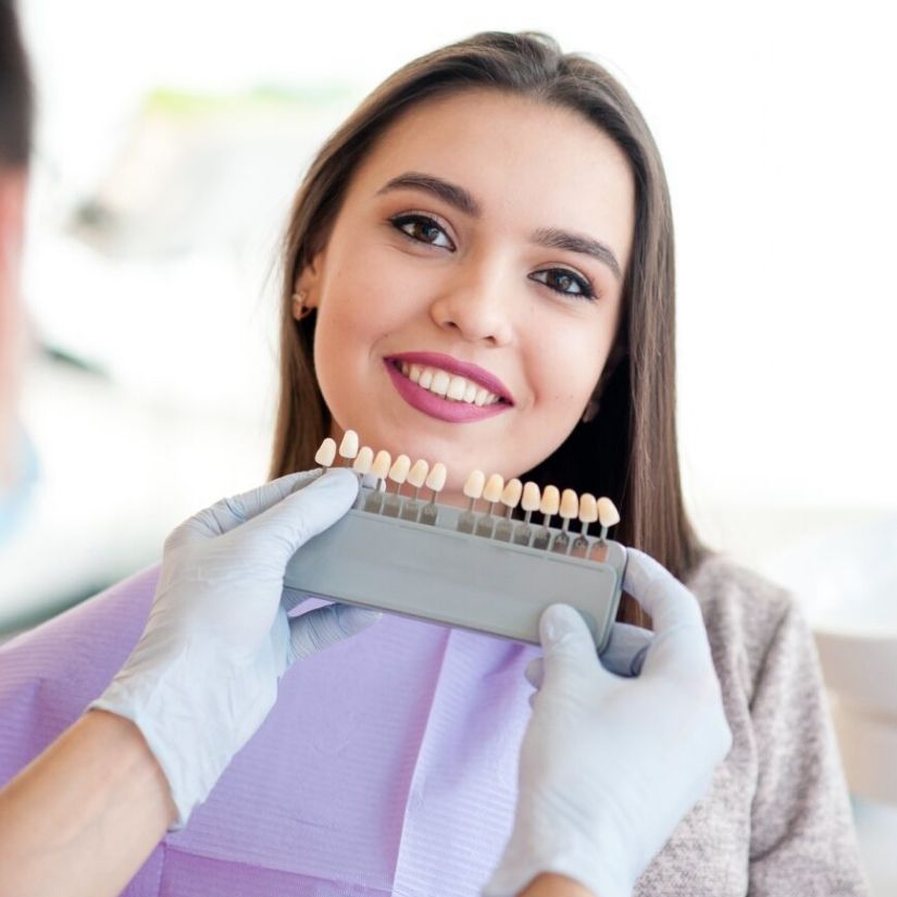 Comparativo entre Facetas de Porcelana e Resina: O que você Precisa Saber.