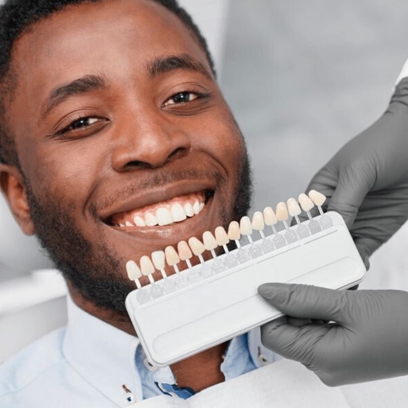 Comparativo entre Facetas de Porcelana e Resina: O que você Precisa Saber.