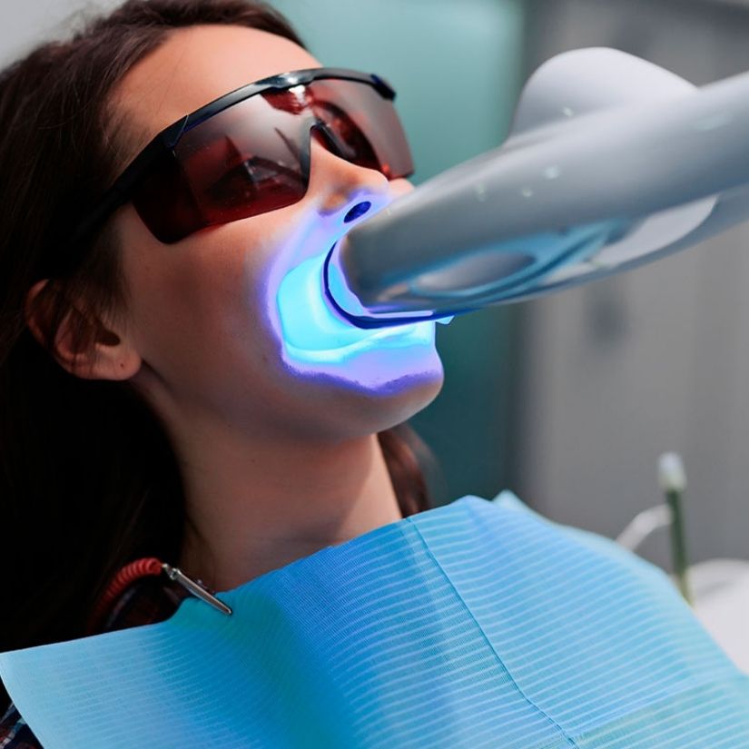 Os Benefícios do Clareamento Dental Supervisionado por um Dentista.