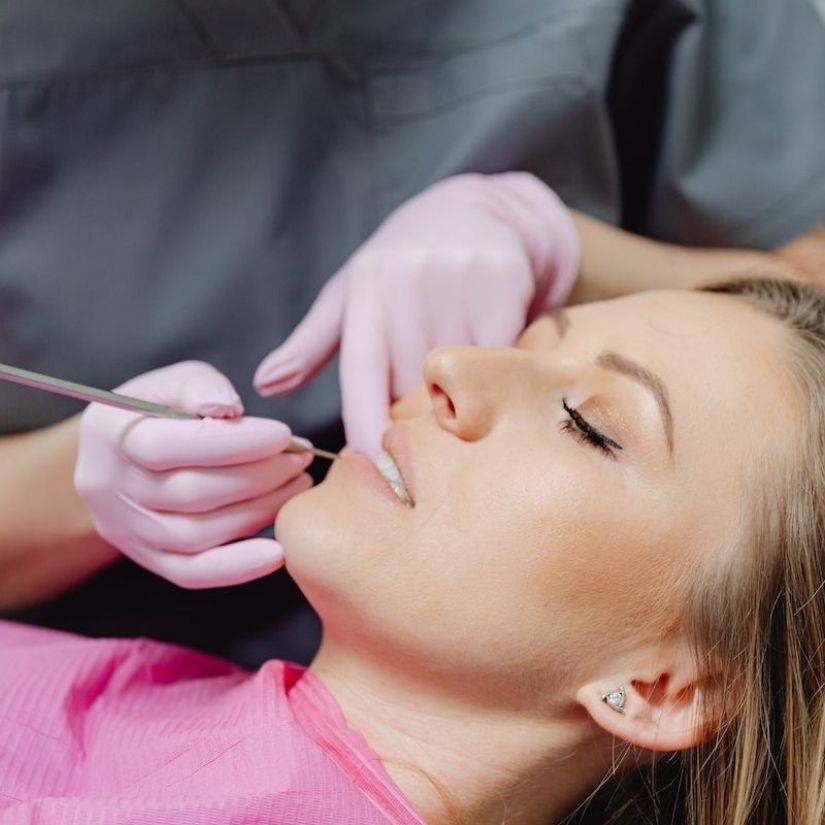 O que é Tártaro e como ele afeta sua Saúde Bucal.