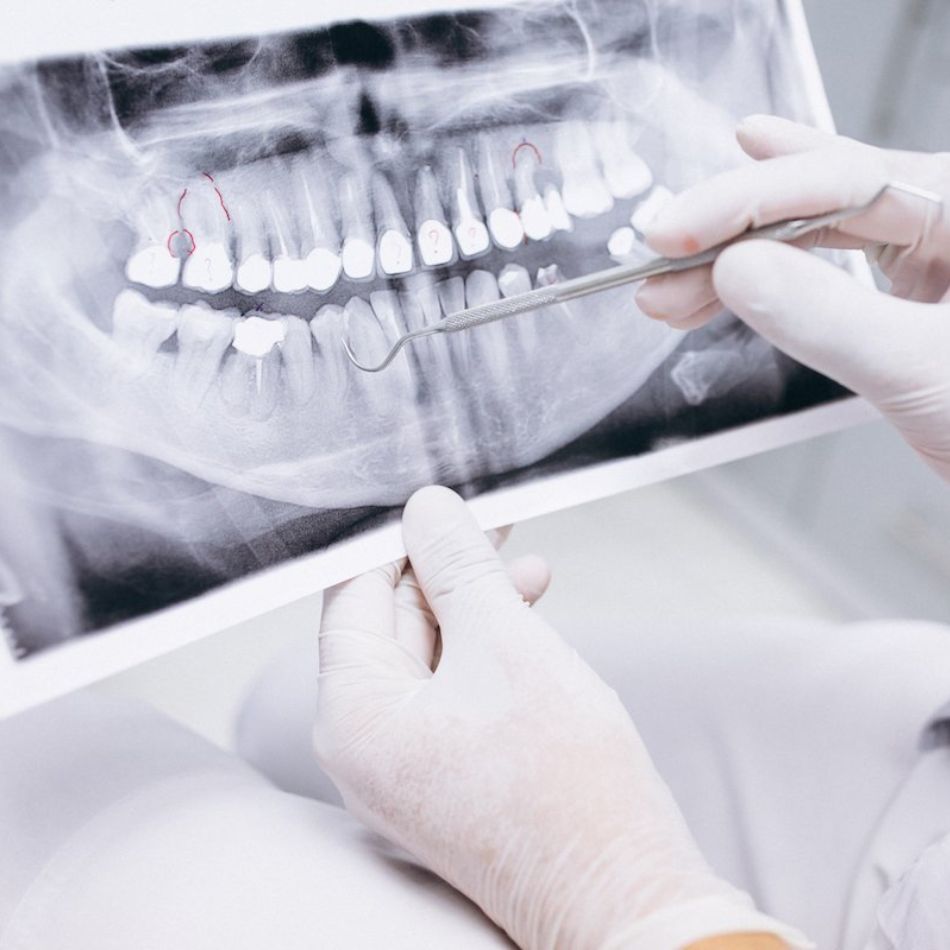 Manutenção da Transposição Dentária: Estética e Funcionalidade.