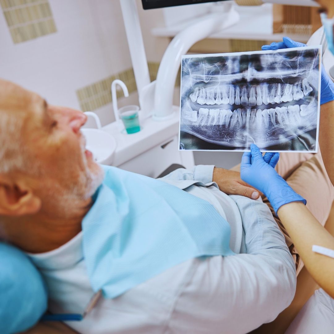 Os implantes dentários são uma solução moderna e eficaz para a substituição de dentes perdidos.