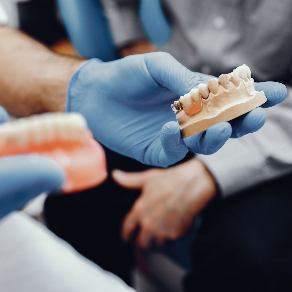 Tipos de Próteses Dentárias e Seus Benefícios.