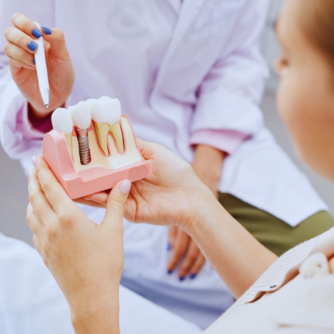 A prótese protocolo é uma solução moderna e eficaz para aqueles que perderam todos os dentes de uma arcada.