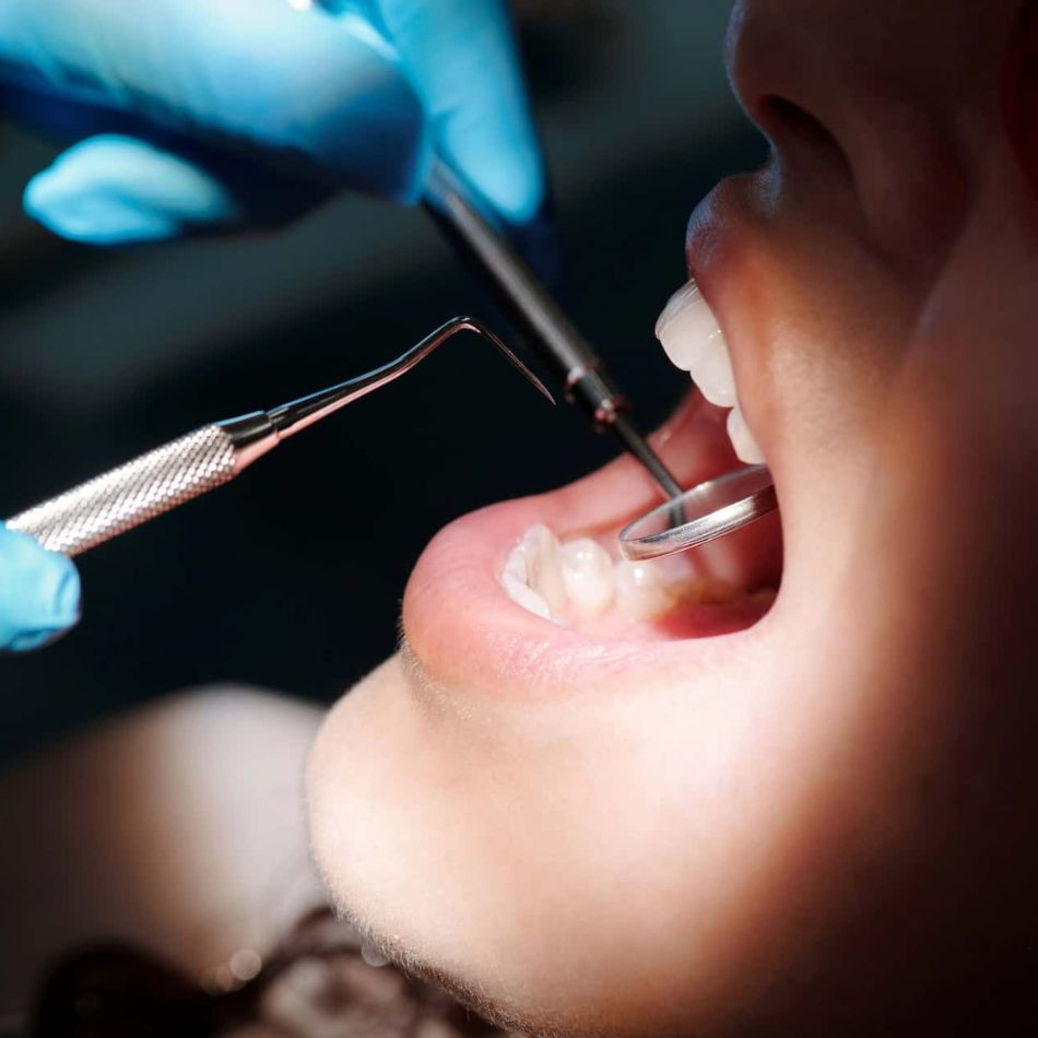 Restauração Funcional Oral e seus Benefícios Diretos para a Saúde Bucal.