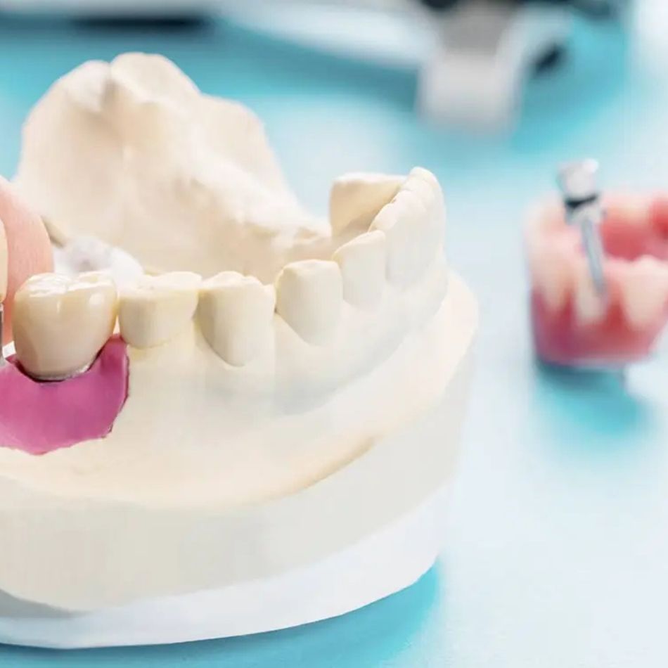 Próteses Dentárias e Mastigação: Como Recuperar sua Saúde e o Prazer de Comer.