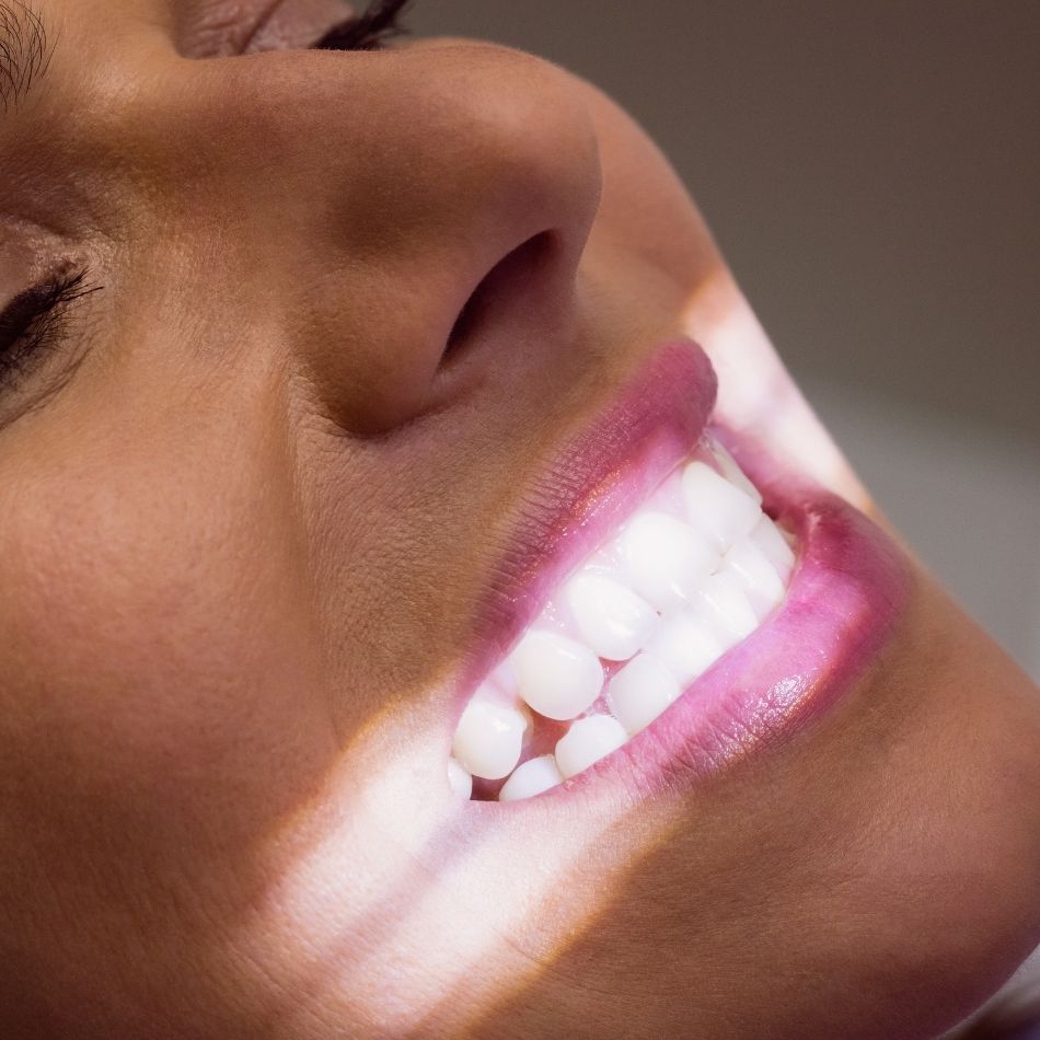 Clareamento Dental Profissional: Conquiste um Sorriso Radiante.
