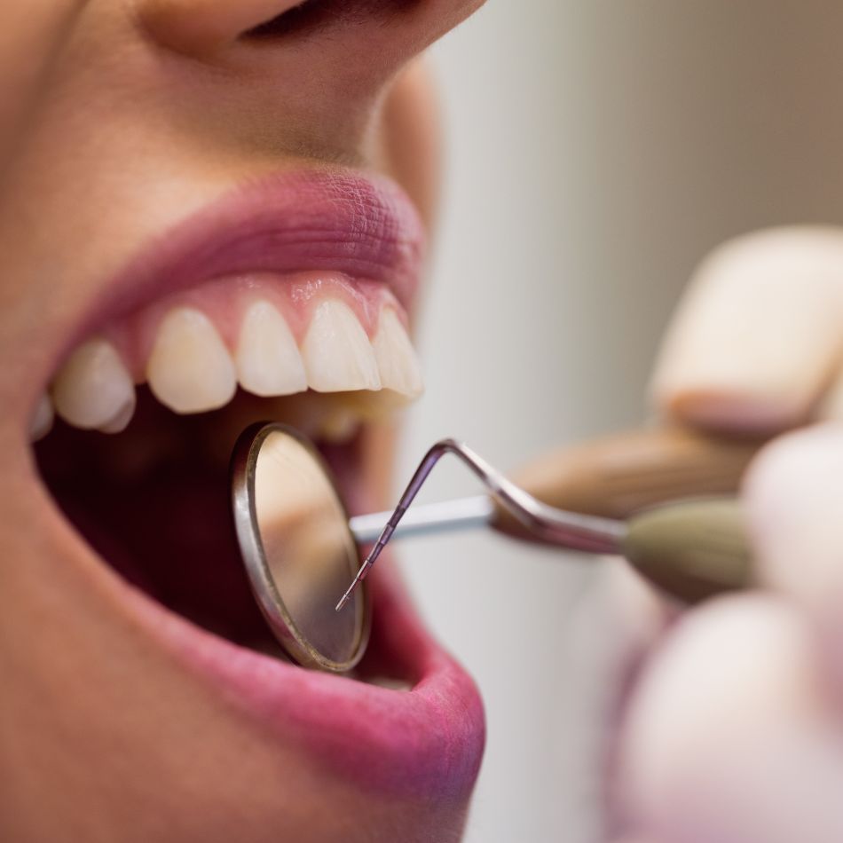 Mucocele Labial: Entenda as Causas, Sintomas e os Tratamentos.
