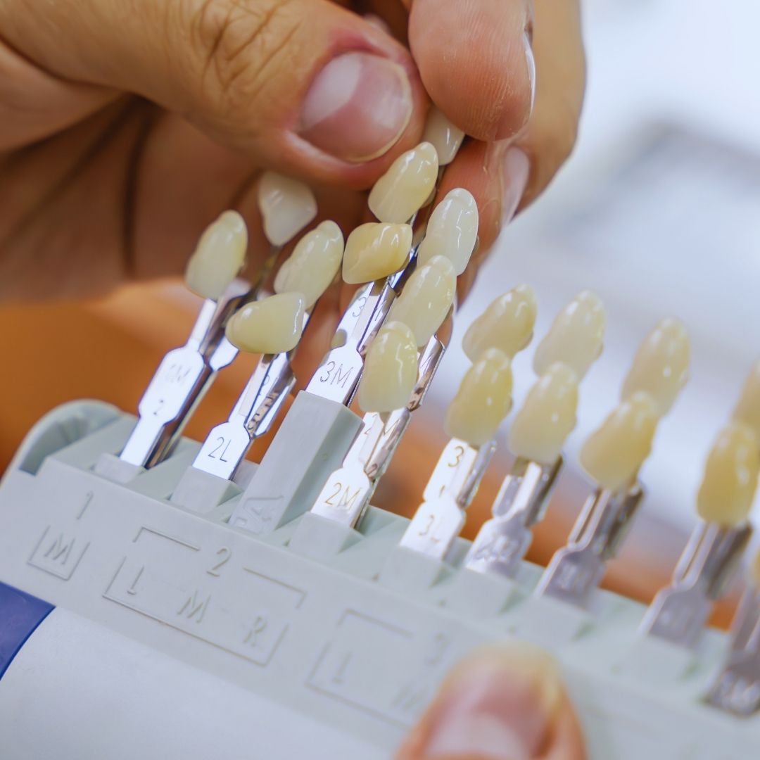 A conquista de um sorriso completo e funcional é o principal objetivo de quem passa por um processo de reabilitação oral. Quando planejamos a confecção de uma coroa, ponte ou prótese protocolo, a preocupação com o formato e a resistência dos novos dentes é imediata, mas existe um fator crucial que determina o sucesso do tratamento: a escolha da cor.