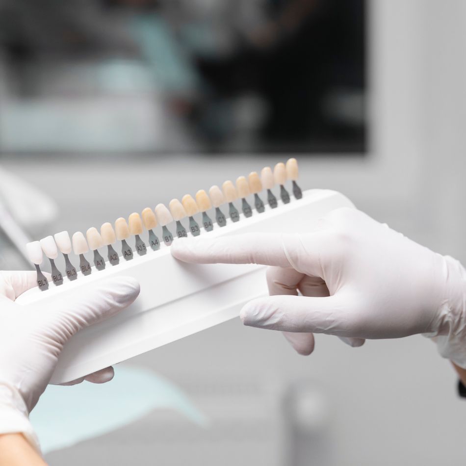 Cores de Dentes para Prótese: Descubra Como Escolher o Tom Ideal.