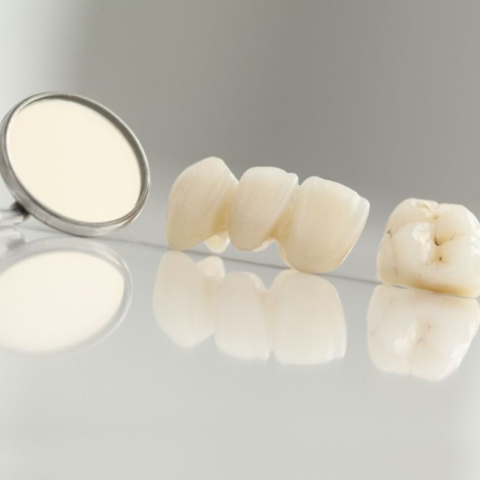 Prótese Fixa Dentária: Tipos, Vantagens e Como Escolher a Melhor Solução.