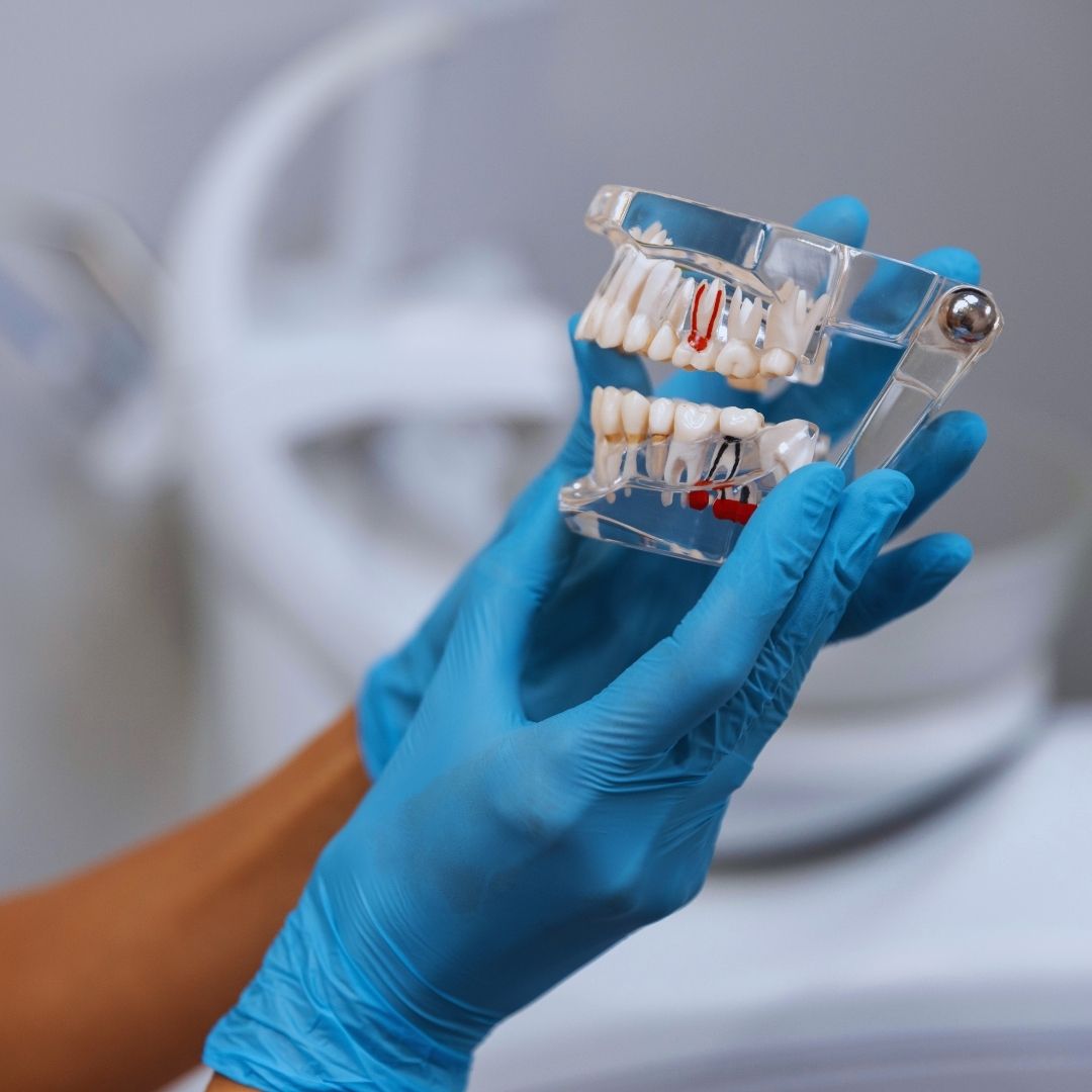A conquista de um sorriso fixo através de implantes dentários devolve a segurança para mastigar, falar em público e sorrir com liberdade.