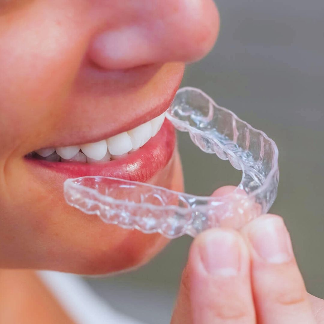 Acordar com dor de cabeça, cansaço no rosto e dentes doloridos é sinal de alerta. A escolha da placa de mordida correta faz toda a diferença para proteger o sorriso e aliviar a tensão.